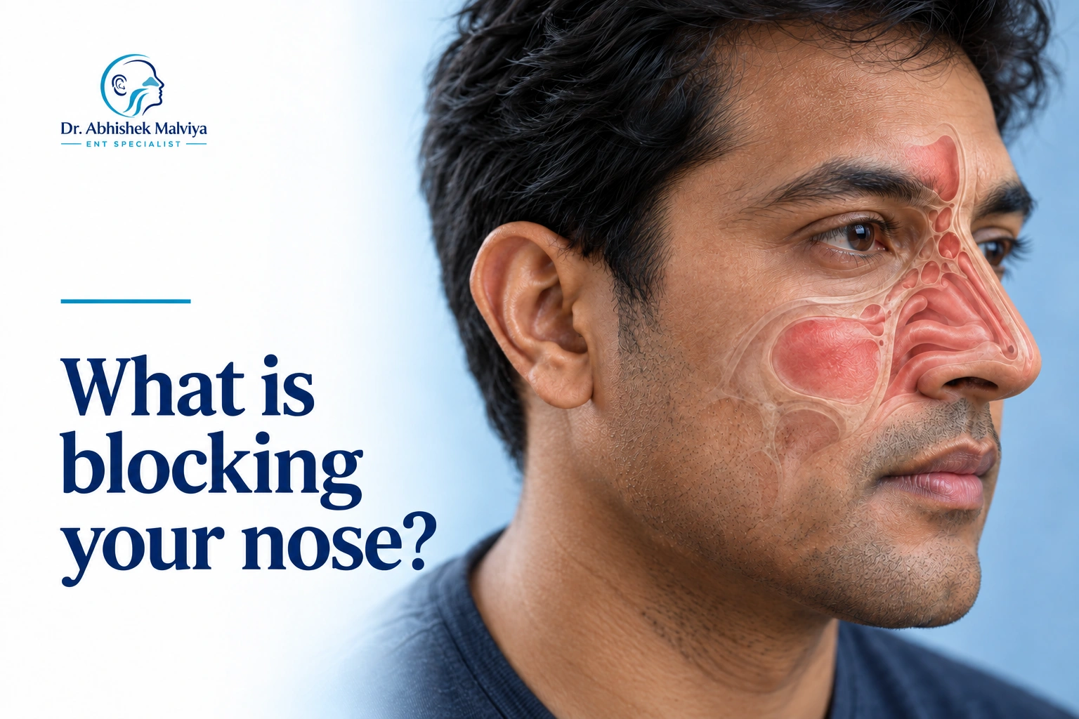 Blocked nose: what your symptoms can tell you
