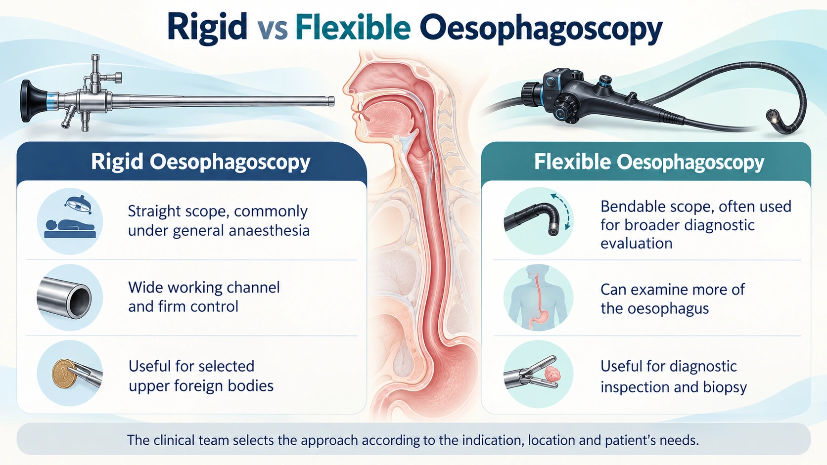 Oesophagoscopy — Rigid and Flexible Oesophagoscopy educational diagram