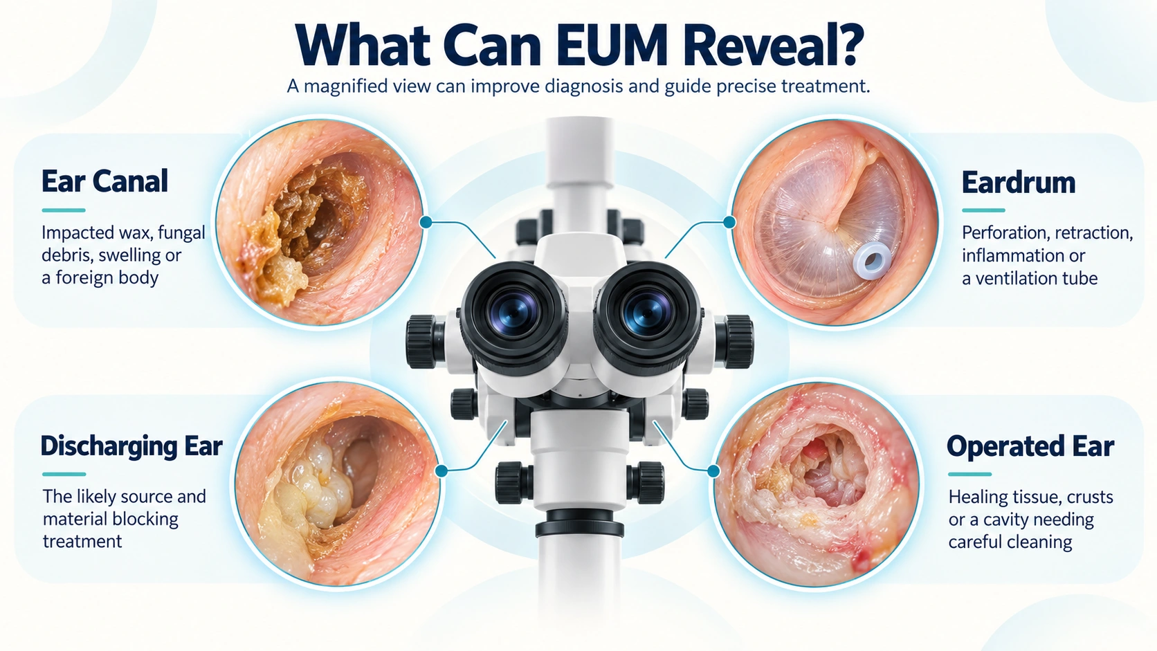 Ear Examination Under Microscope (EUM’s) — What Can EUM Reveal? educational diagram